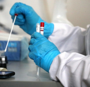 Statistics on COVID-19 infection over Azerbaijan announced